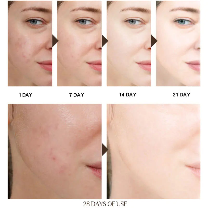 Rejuvenating Anti-Aging Moisturizing Skin Cream