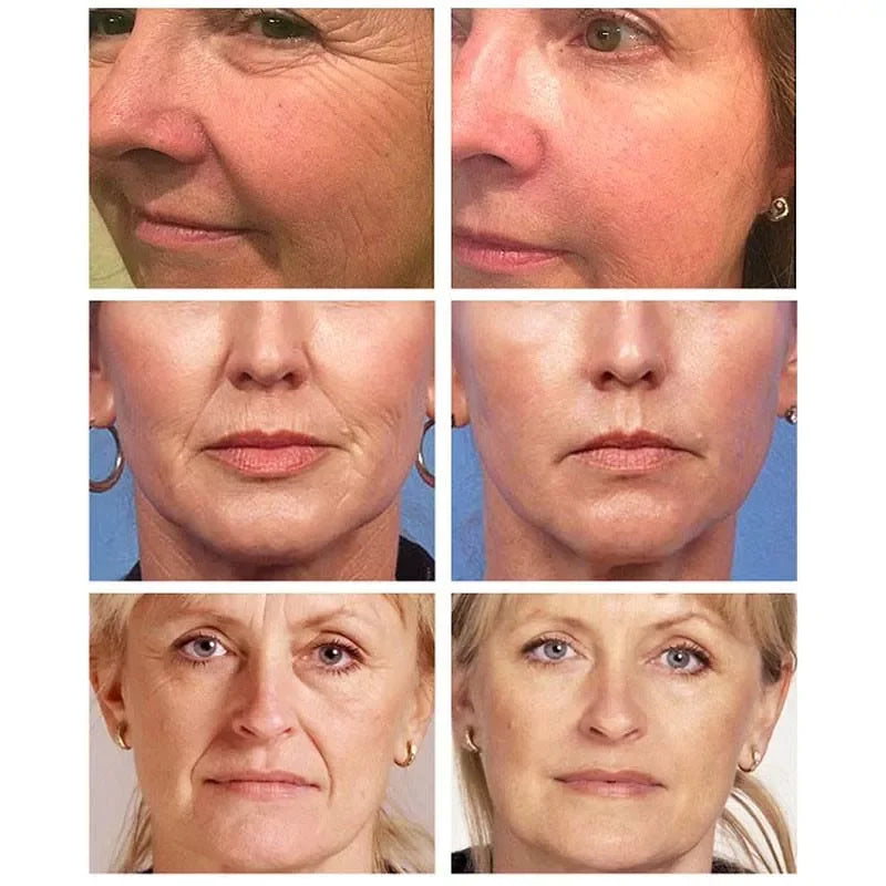 Rejuvenating Anti-Aging Moisturizing Skin Cream
